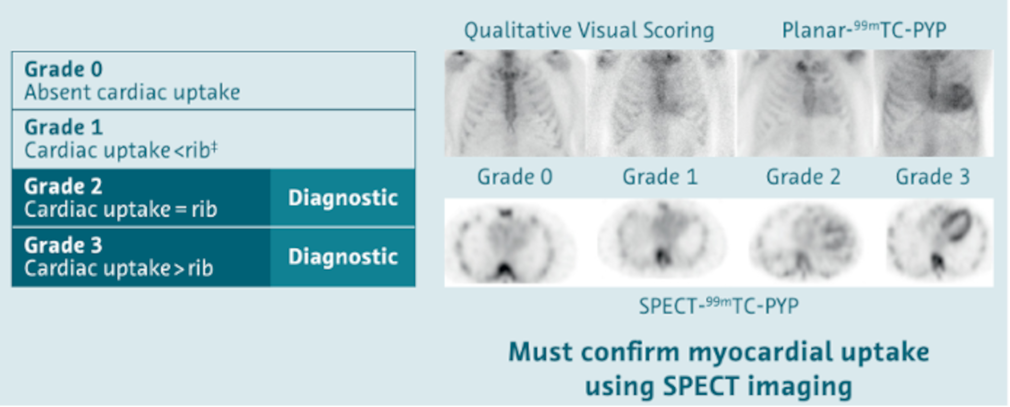 Visual grading of scintigraphy findings in ATTR-CM Visual grading of scintigraphy findings in ATTR-CM